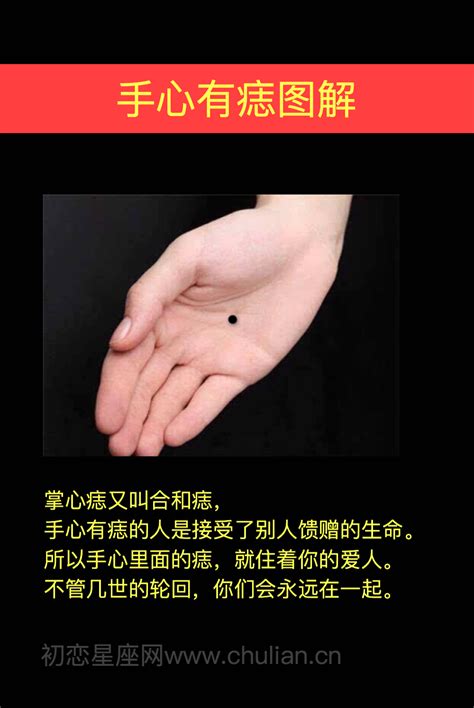 手心有痣的女人|女人手掌有痣代表什么 手掌上的痣的位置与命运图解